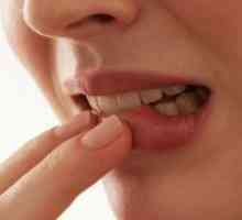 Parodontitis, zub - što je to?