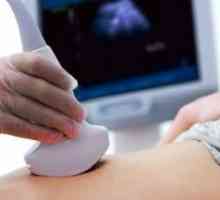 Prvi ultrazvuk u trudnoći