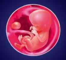 Plod trudna 14 tjedana