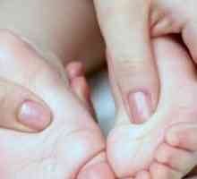Ploskovalgusnye stopala u djece - liječenje