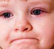 Crvenilo očiju na dijete - što učiniti?