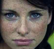 Korisni savjeti o tome kako da biste dobili osloboditi od freckles