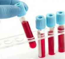 Smanjena hemoglobina - Simptomi