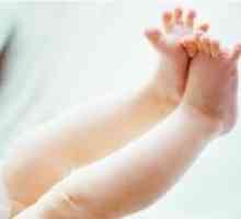 Znojne noge bebe