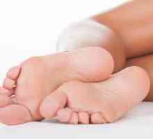 Znojenje noge - uzroci i liječenje