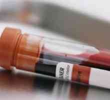 Povećana inzulina u krvi - uzroci