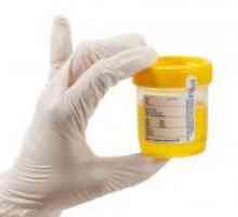 Povećana leukocita u urinu djeteta - uzroci