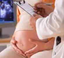 Prenatalni probir