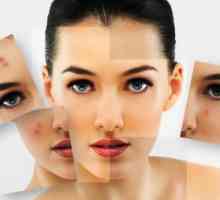 Problem s kožom: 7 zanimljivi zablude o aknama
