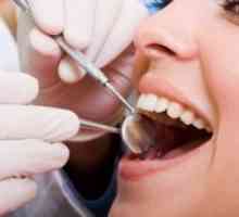 Stručni oralna higijena