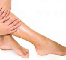 Prevencija proširenih vena u nogama