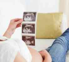Proginova tijekom trudnoće