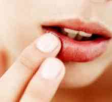 Hladno na usnama - kako brzo liječiti?