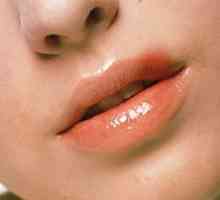 Hladno na usnama: tajne učinkovitog i brzog zbrinjavanja