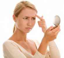 Akne na čelo: Uzroci, liječenje, kako ukloniti
