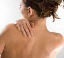 Akne na leđima - uzroci