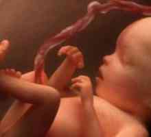 Pupčana vrpca u novorođenčadi