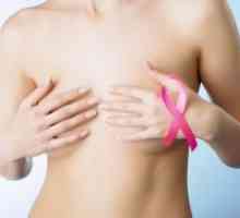 Rak dojke - Simptomi