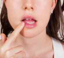Rak usne - simptomi, rani znakovi