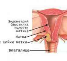 Rak vrata maternice - znakovi