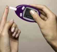 Dijabetes - simptomi kod žena