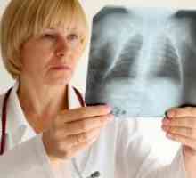 Sarkoidoza pluća - simptomi