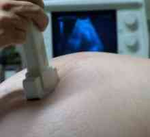 Otkucaji srca fetusa tijekom trudnoće