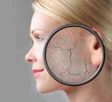 Jako ljuskava koža na licu: uzroci i liječenje