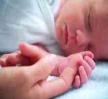 Sindroma respiratornog distresa kod novorođenčadi
