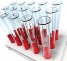 Kompatibilnost krvnih grupa za začeće