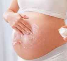 Lijek za strije tijekom trudnoće
