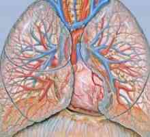 Plućna stenoza