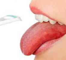Rak čireve na jeziku - liječenje kod odraslih