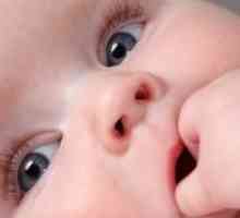 Stomatitis u dojenčadi