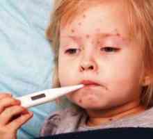 Streptoderma u djece - lijekovi za liječenje