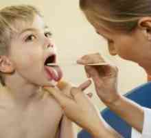 Streptokokne infekcije kod djece