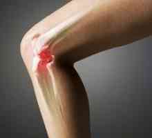 Artritične vježbe za koljena