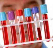 Trombocitoza - uzroci i liječenje