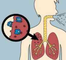 Tuberculosis - Liječenje