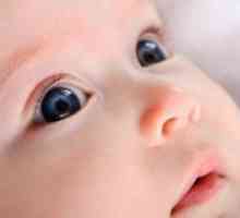 Dijete zagnojiti oči - što učiniti?