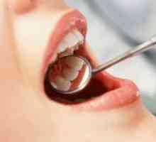 Uklanjanje zubnog živca