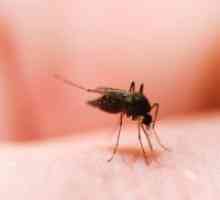 Ujeda komaraca - kako ukloniti otekline?