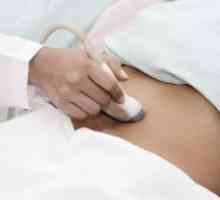 Karlica ultrazvuk kod žena - kako se pripremiti?