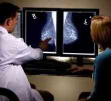 Ultrazvuk dojki - normalno