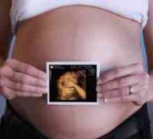 Ultrazvuk od 12 tjedana fetus