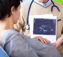 Fetalni Ultrazvuk po tjednu