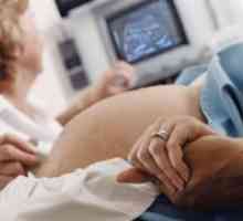 Ultrazvuk srca fetusa