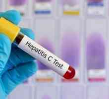 Količina virusa u hepatitisa s