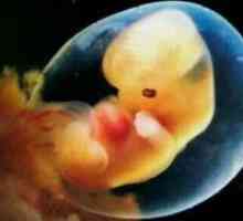 Vitrifikacija embrija