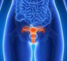 Unutarnji endometrioza - liječenje